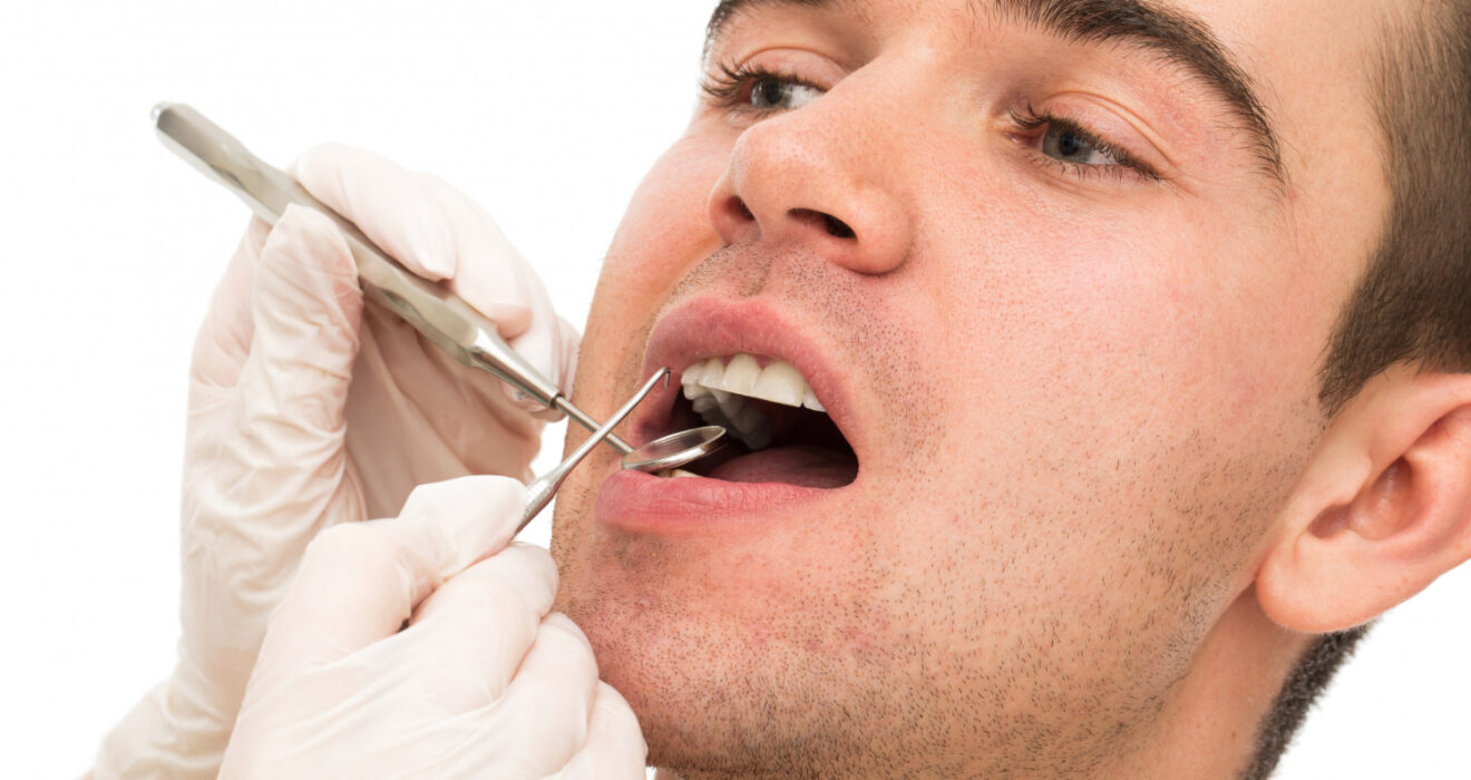 gingivitis-treatment-rockville-md