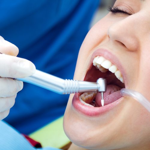 Restorative Dentistry in Rockville