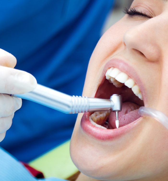 Restorative Dentistry in Rockville