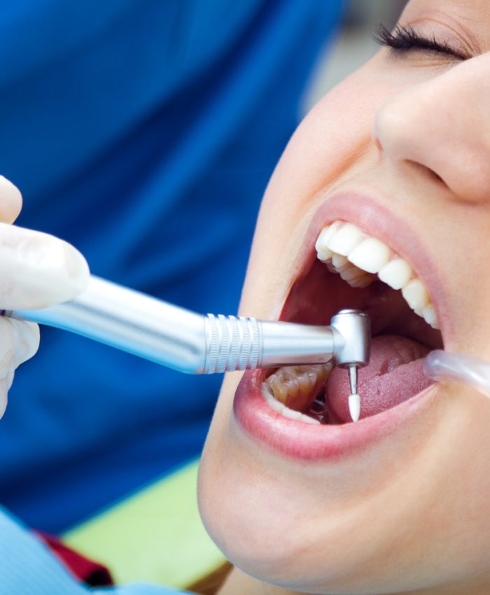 Restorative Dentistry in Rockville
