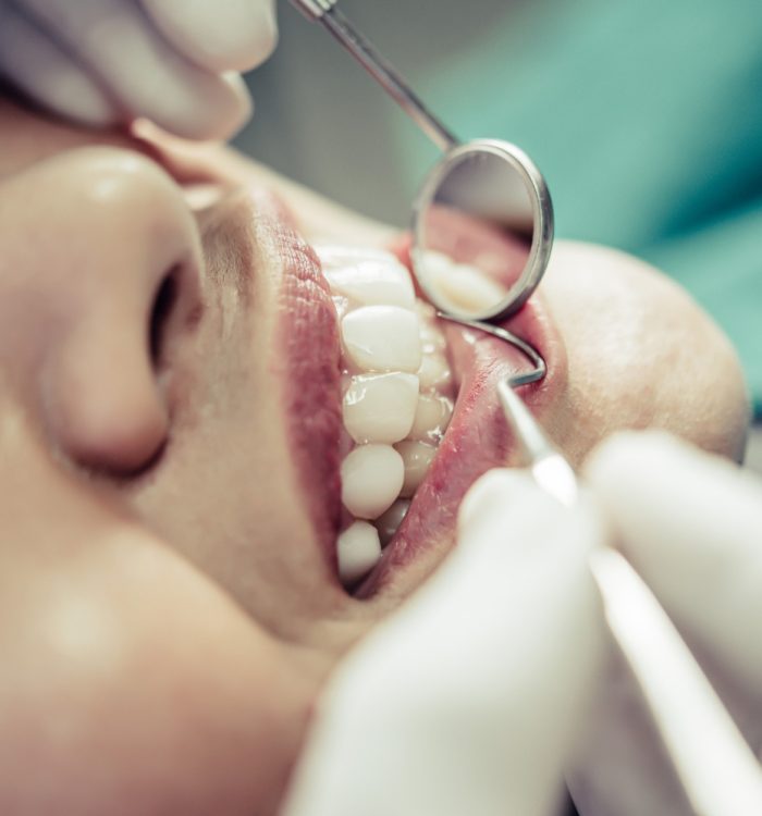 affordable-gum-disease-treatment-rockville-md