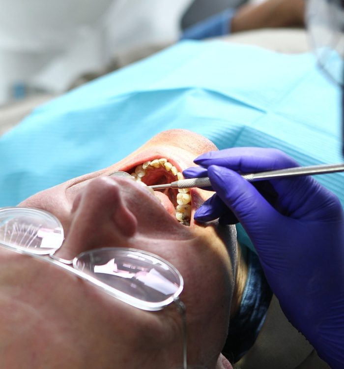 deep-teeth-cleaning-rockville-md