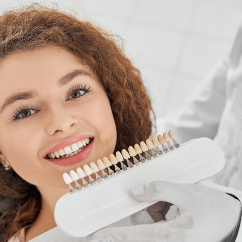 dental veneers rockville md