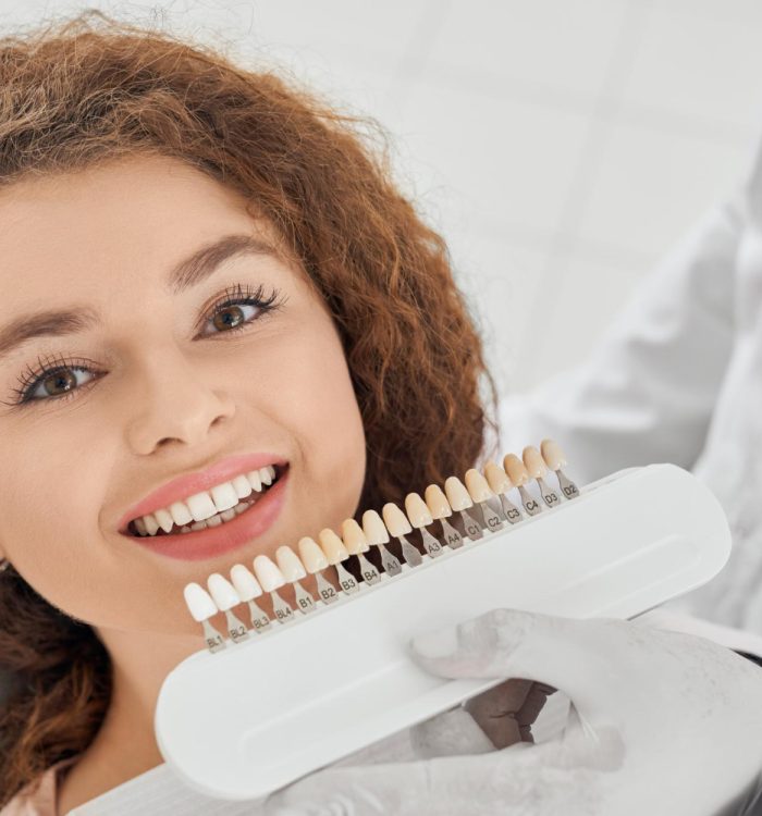 dental veneers rockville md