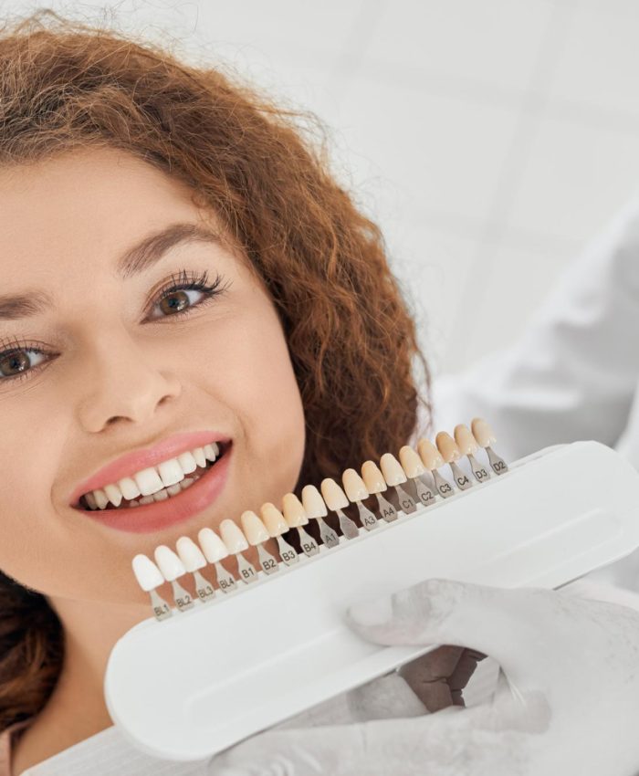 dental veneers rockville md