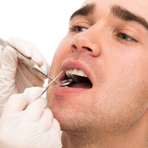 gingivitis-treatment-rockville-md