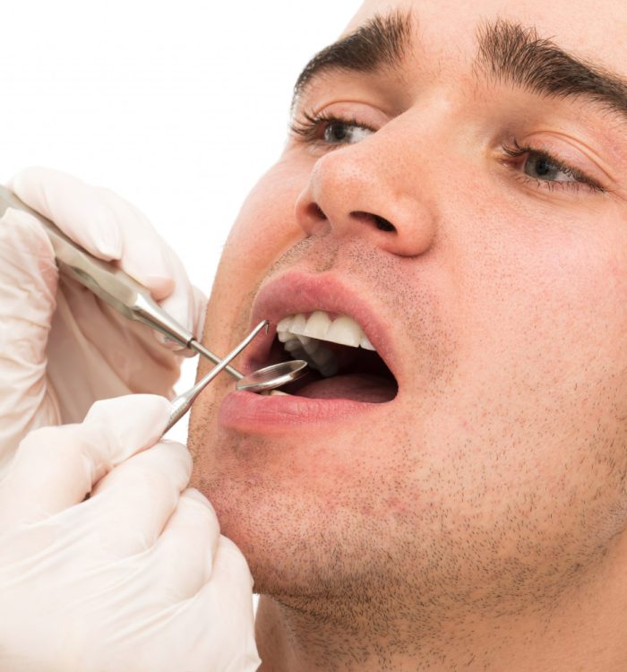 gingivitis-treatment-rockville-md