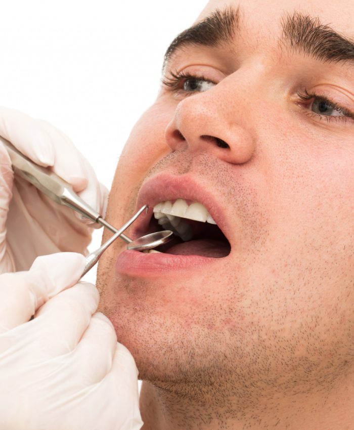 gingivitis-treatment-rockville-md